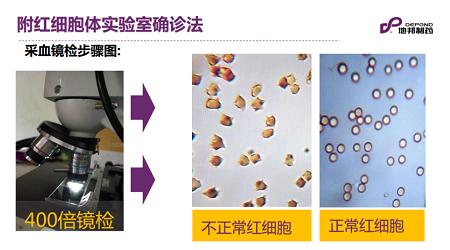 猪贫血最好的防治方法,大猪附红细胞体死亡率大吗