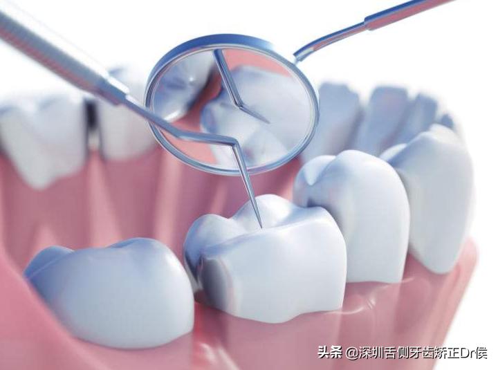 值得收藏的牙齿护理时间表,怎么护理牙齿才能用一辈子