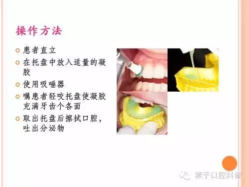 蛀牙治疗科普,蛀牙安全有效的方法