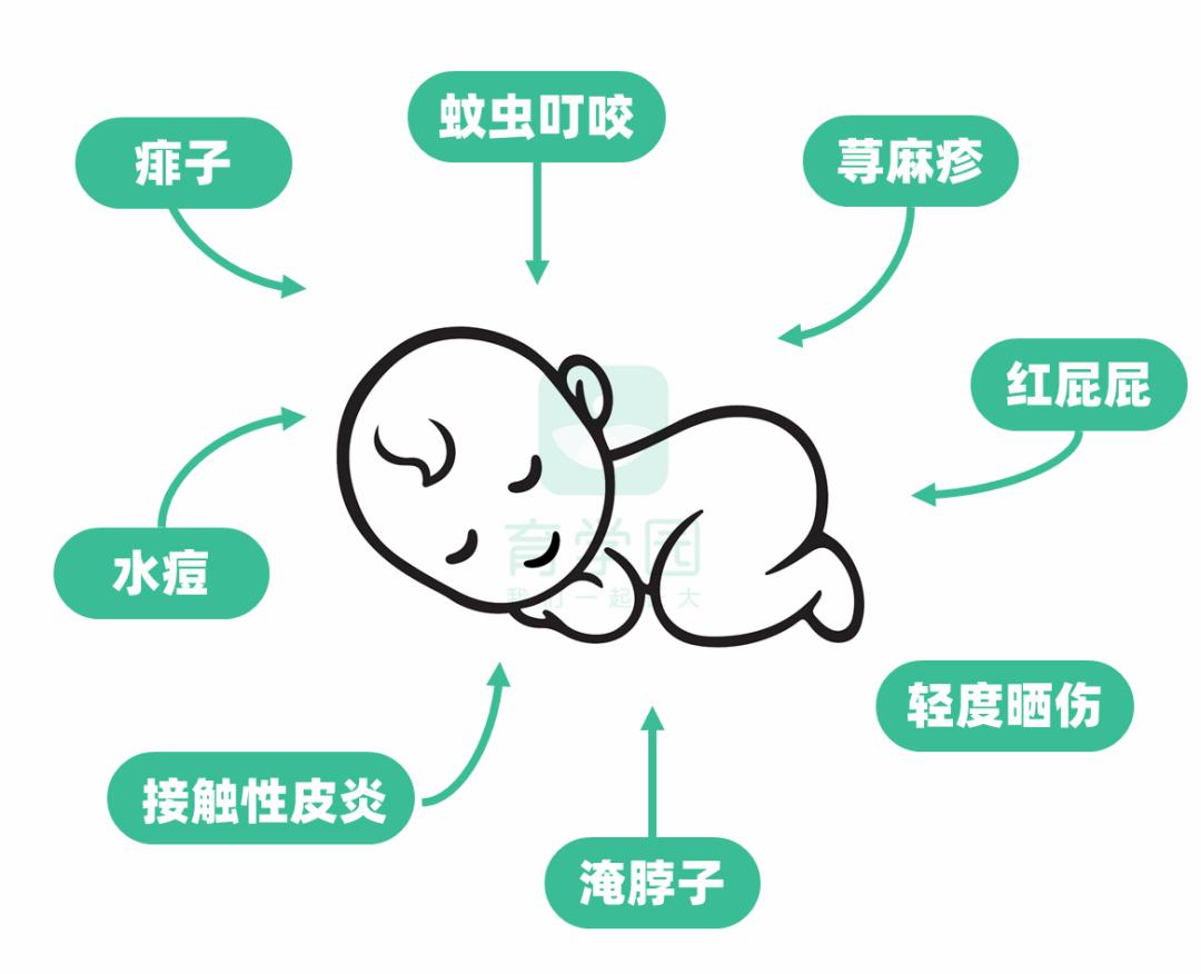 婴儿蚊虫叮咬止痒痱子药膏第一名,一元抹的治蚊虫叮咬药