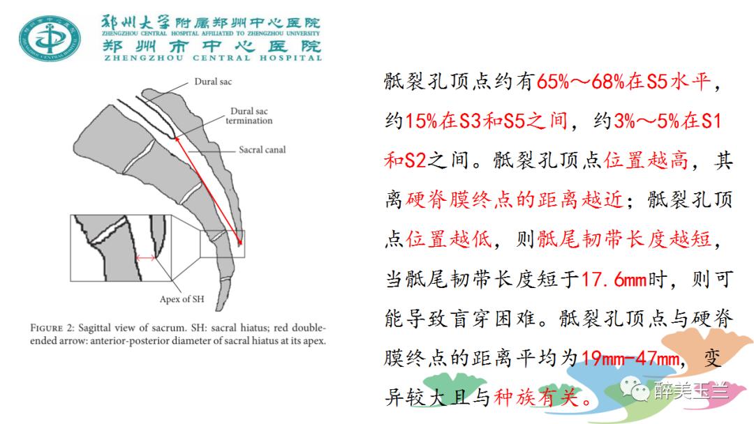 局麻药中毒的术前用药口诀,局麻药中毒临床表现及处理流程ppt