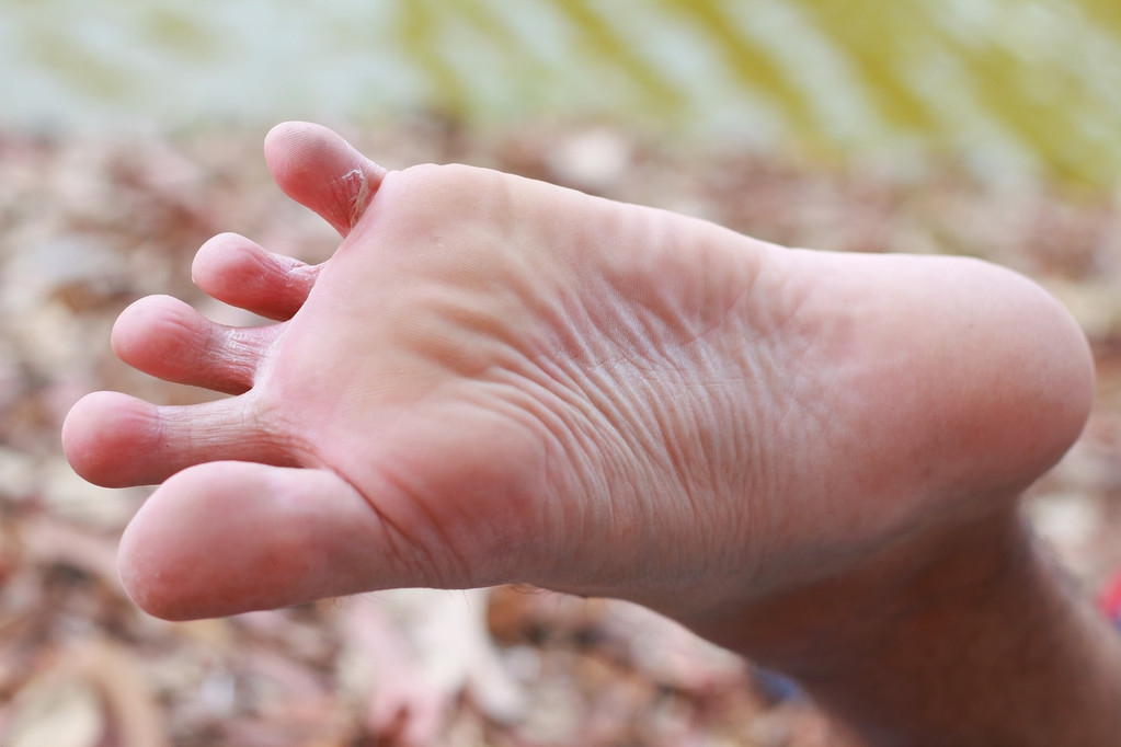 脚臭还脱鞋的人怎么治,日本人进门就换鞋脚臭怎么解决