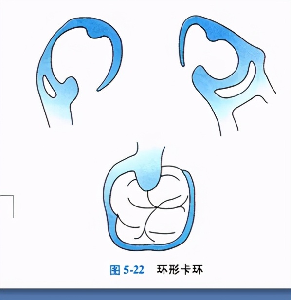 牙列缺损的可摘局部义齿修复题库,牙科美学修复精讲