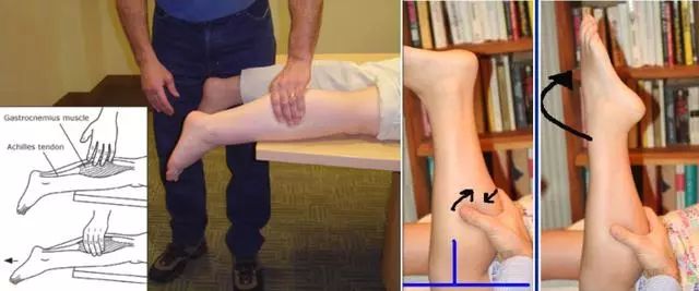 运动医学分析运动损伤案例,运动医学跟腱撕裂