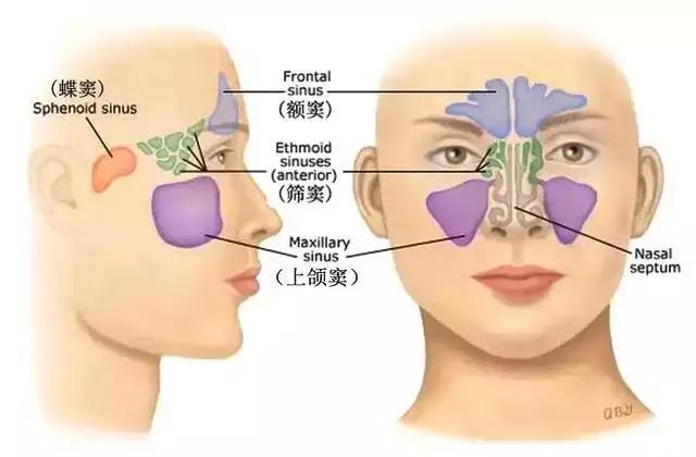 鼻炎与鼻窦炎的区别图解,鼻窦炎和鼻炎的对比