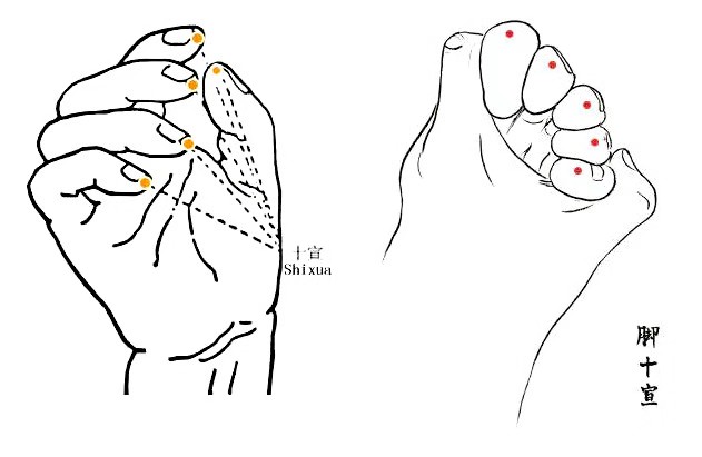 中风急救100个技巧,中风的急救方法和技巧