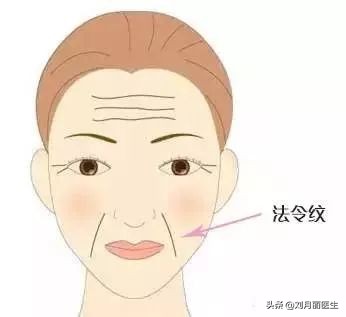 修复苹果肌改善法令纹,改善法令纹的面部运动