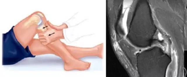mri临床医师必读电子书,临床医生如何读mri