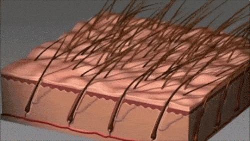 坚持健身半年居然秃了,20岁小伙子坚持健身半年竟然秃了