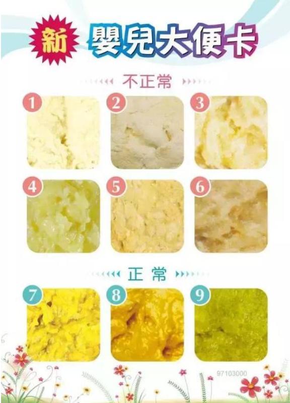 刚出生宝宝排便多少次才正常,新生儿排便次数多且绿色