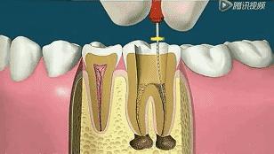 还记得被支配的恐惧吗,澳洲牙膏排行榜前十名