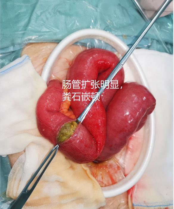 老人家能吃冬笋吗,老人吃竹笋会发病吗