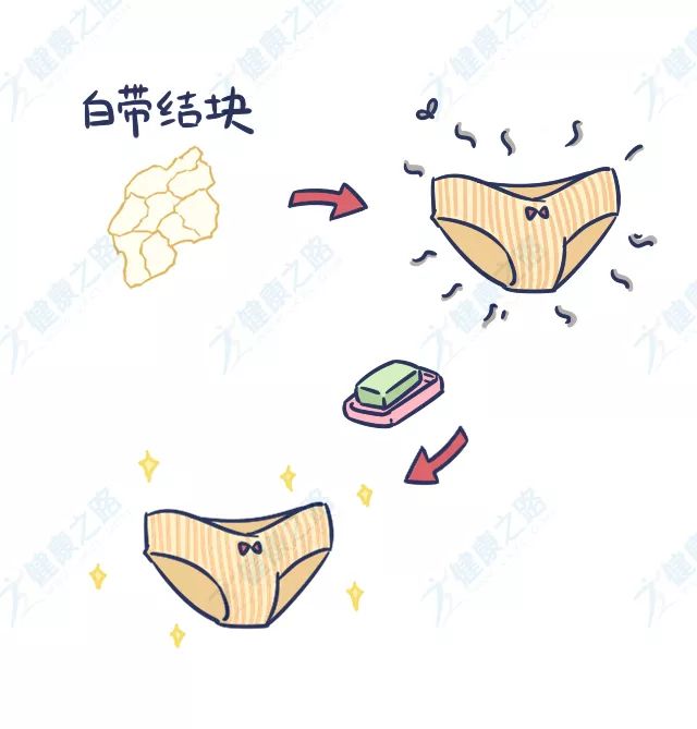 白带在裤头上呈白色正常吗,白带在裤子上干了变黄