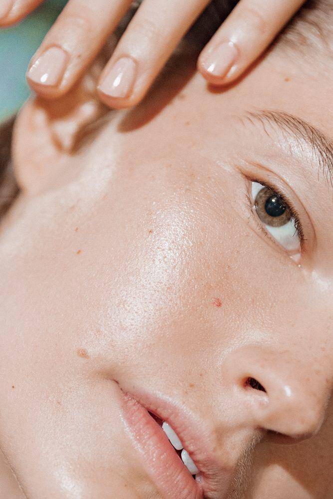 晒后皮肤疼如何快速修复,晒伤后出的晒痕如何处理