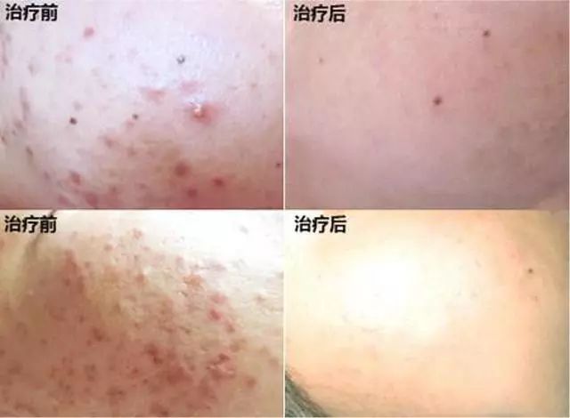 香港明星同款冻干面膜,各路明星推荐的面膜怎么样