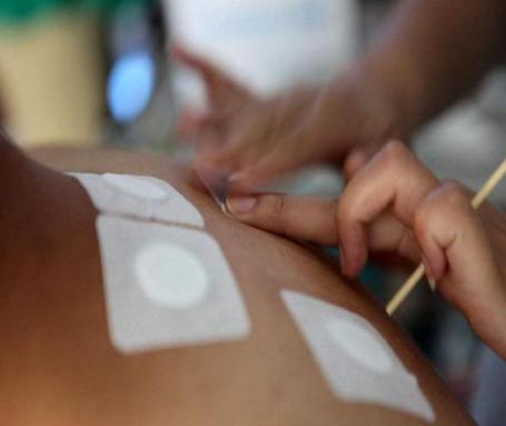 兖矿新里程总医院中医科主任,三伏贴医院贴的视频