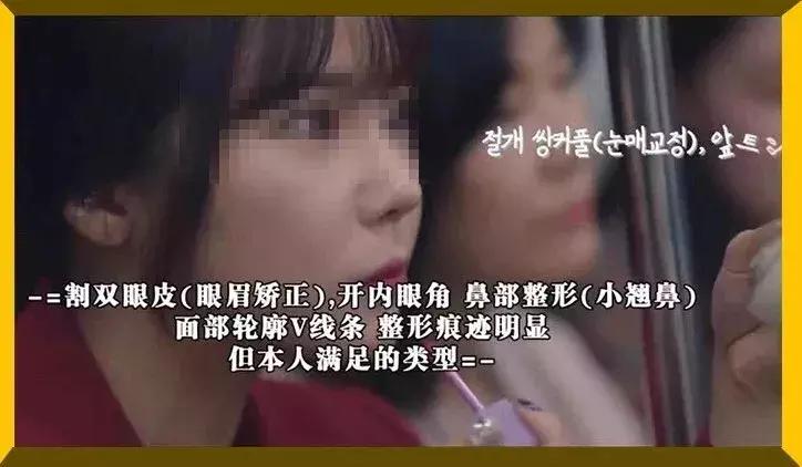 花了26万做整容手术,24岁女子花21万整容