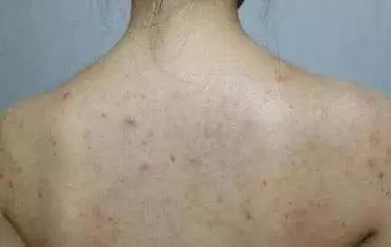 日本变态搓澡巾又来了！轻松搓泥如下雨，网友：20年的澡白洗了