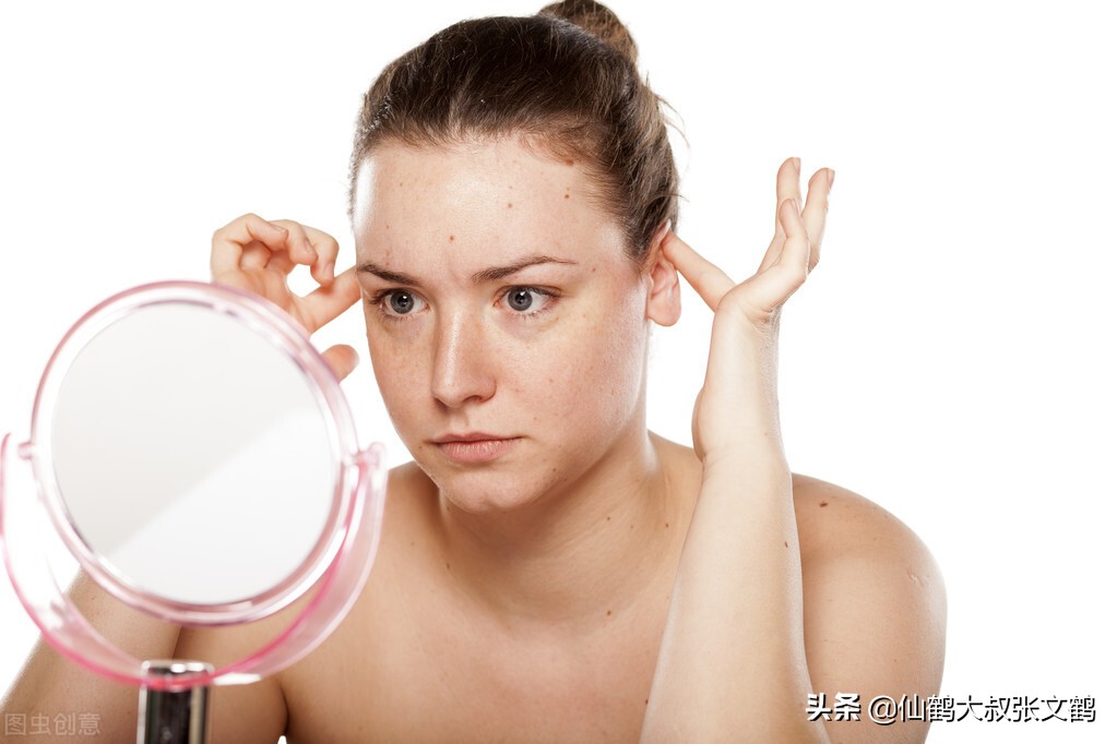 告别痘痘祛痘印方法,告别痘痘粉刺改善肌肤问题
