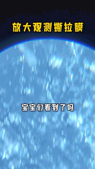 去黑头的六个误区,去黑头项目建议做吗