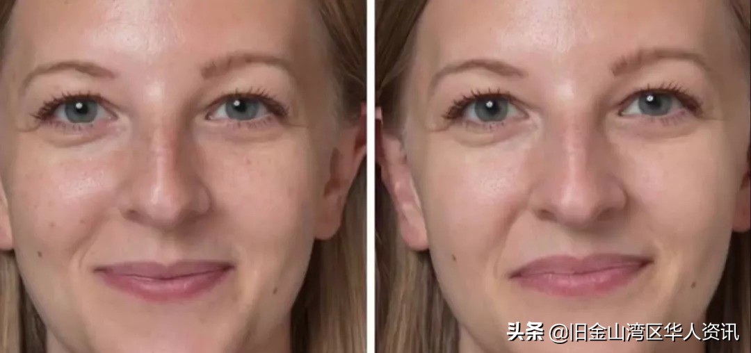 鑴搁儴澶勭悊ps,鐟曠柕鑴镐慨澶峱s