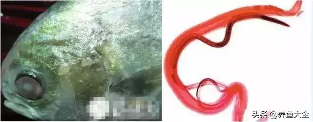 寄生虫多达6000条这种东西别乱吃,寄生虫的典型症状和表现