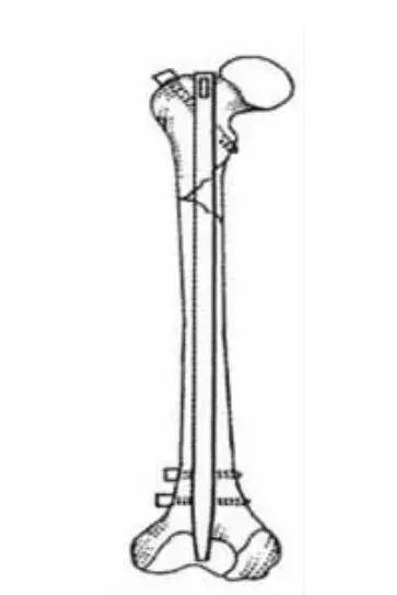 猫咪狗狗骨折了怎么办？扒一扒宠物“骨子里”的那些事