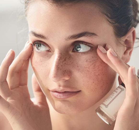 眼周水肿的原因分析,如何改善眼皮浮肿