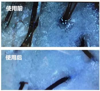 头发蓬松茶树油洗发水,油头救星澳洲茶树洗发水