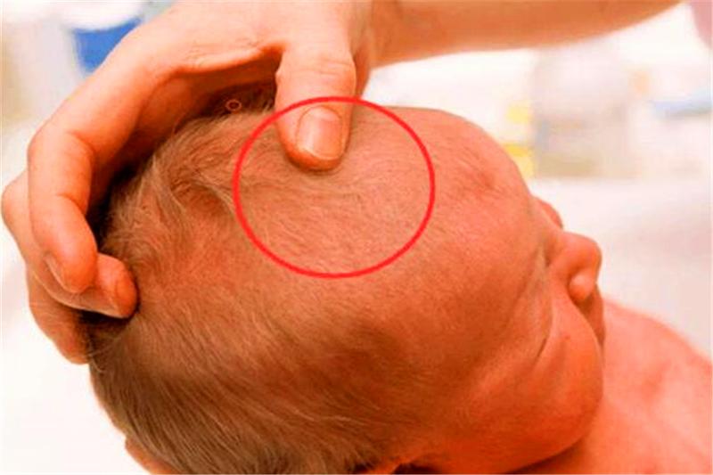 为什么人类分娩比其他动物更痛苦,为什么动物分娩比人容易分娩