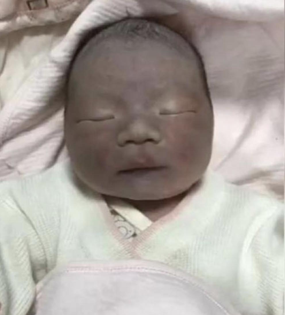 新生儿有点黑怎么办,刚出生的婴儿太黑怎么办