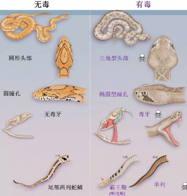 毒蛇咬伤截肢,毒蛇咬食指怎么处理