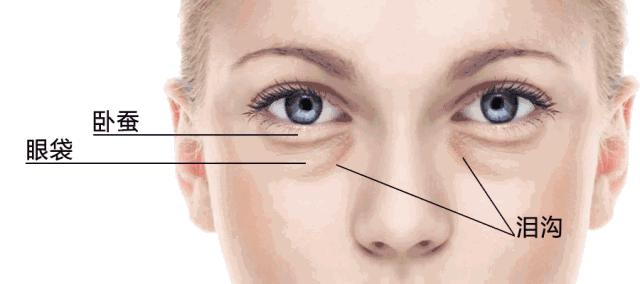 你的黑眼圈是怎么治好的,黑眼圈就是如此熬来的