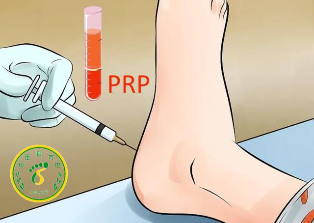 跖筋膜炎和足跟脂肪垫炎,足底筋膜炎怎么缓解疼痛