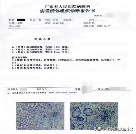 萎缩性胃炎离我们很近，我建议你看一看这篇文章