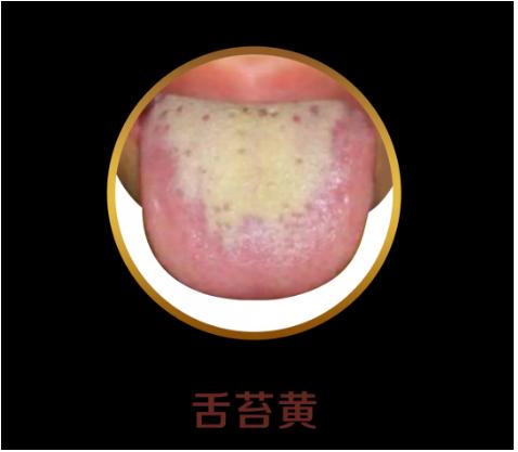 如何通过舌苔判断宝宝健康,中医教你从14种舌头的舌象看健康