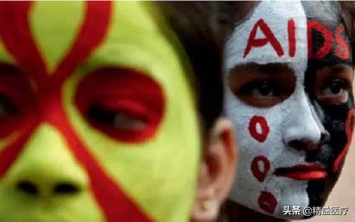 恐艾滋病和得了艾滋病的区别,恐艾会出现和艾滋病一样的症状吗