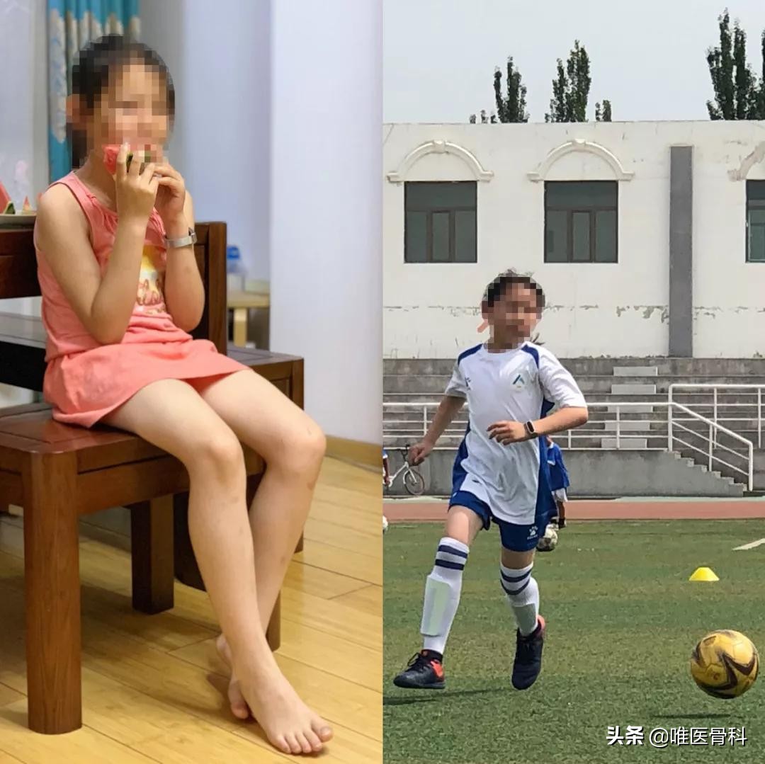 长腿秘诀大全图解,原来大长腿是这样炼成的