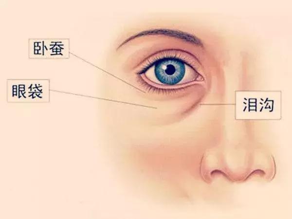 30岁眼部细纹泪沟眼睛显老怎么办,看着像眼袋其实是泪沟