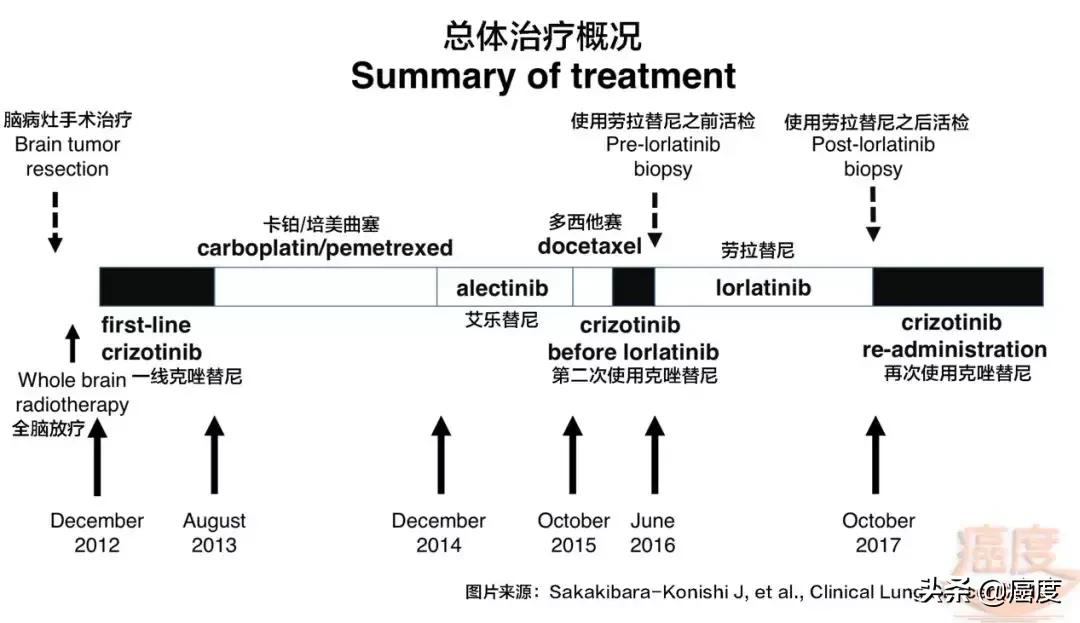 劳拉替尼耐药吃回克唑替尼,劳拉替尼耐药后改服阿来替尼