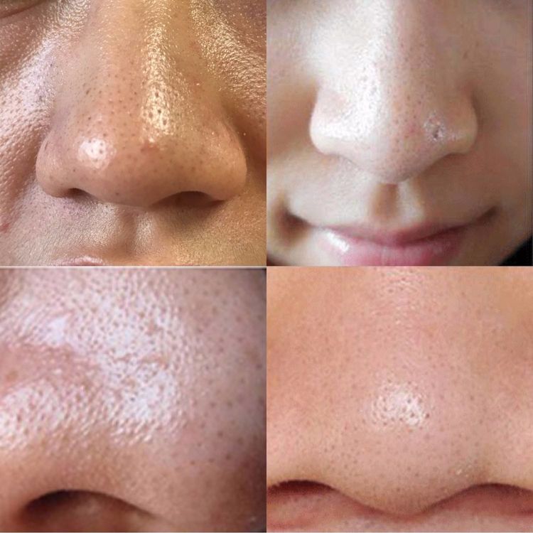 鼻子不挺就算了,为何还变丑了?你这3个“小动作”,难怪鼻子塌