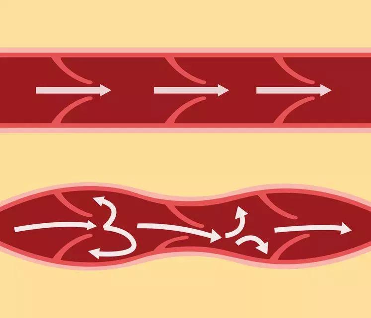 鎸ょ棙寰楅鍐呮劅鏌撶殑姒傜巼澶氬ぇ,鎸ょ棙鎰熸煋