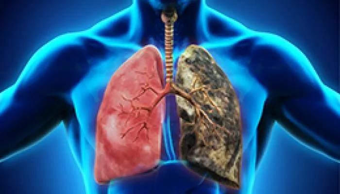 癌症治疗多面手！NK细胞免疫疗法，或将成为晚期癌症治疗最佳选择