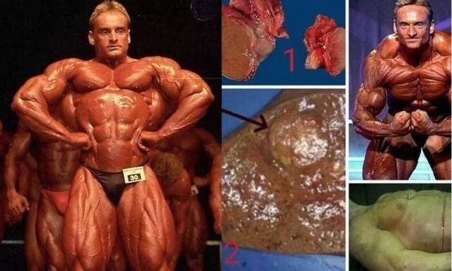 健美运动员意外去世,奥赛健美哪位选手去世了