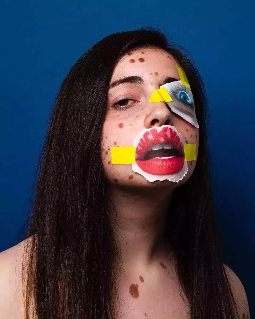 全身黑斑被骂“斑点狗”，身高160的她却成为最美超模…