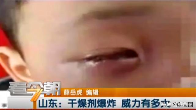 干燥剂遇水爆炸眼睛,干燥剂爆炸伤到眼睛的视频