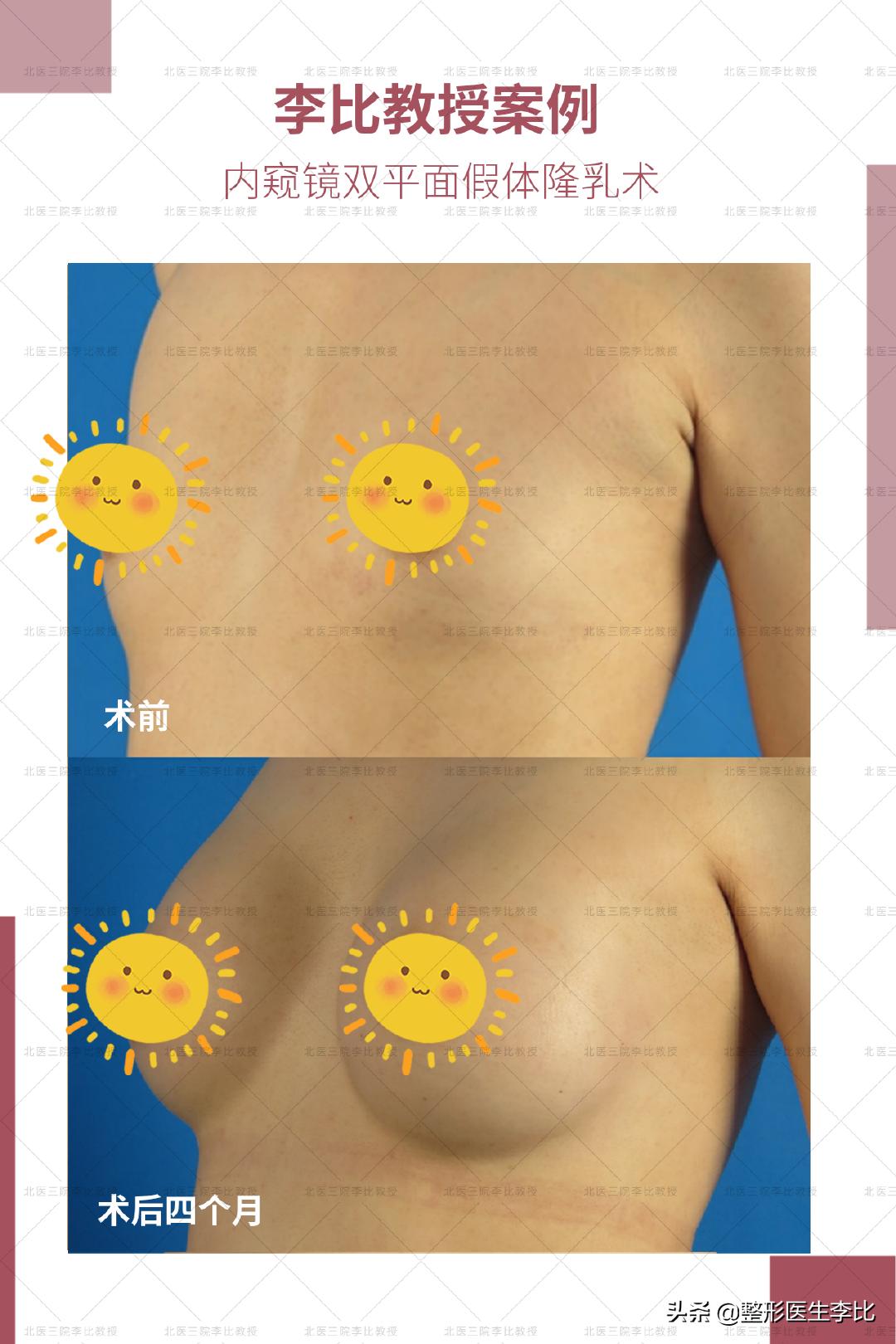 我有一对不会长大的胸，怎么办？（含案例）