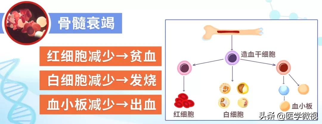 居里夫人再生障碍性贫血,居里夫人患贫血
