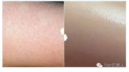 法国药妆哪个最好用,好用的法国淡斑药妆