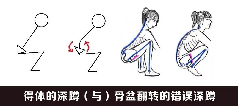 下背部老是酸痛是怎么回事,负重深蹲后腰疼怎么解决